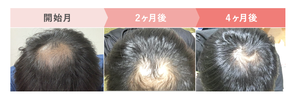 画像に alt 属性が指定されていません。ファイル名: %E3%82%B9%E3%82%AF%E3%83%AA%E3%83%BC%E3%83%B3%E3%82%B7%E3%83%A7%E3%83%83%E3%83%88-2022-11-26-131831.png