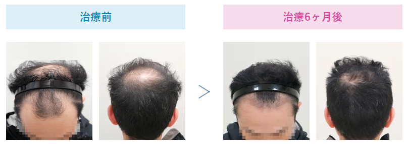 画像に alt 属性が指定されていません。ファイル名: %E3%82%B9%E3%82%AF%E3%83%AA%E3%83%BC%E3%83%B3%E3%82%B7%E3%83%A7%E3%83%83%E3%83%88-2022-11-26-145705.png